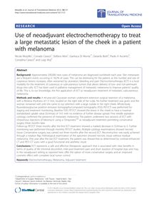 Use of neoadjuvant electrochemotherapy to treat a large metastatic lesion of the cheek in a patient with melanoma