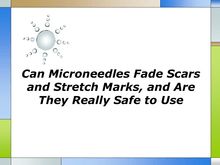 Can Microneedles Fade Scars and Stretch Marks and Are They Really Safe to Use