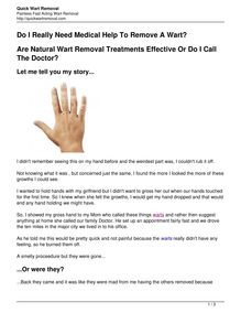 Wart Removal That You Can Try From Home