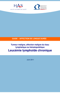 ALD n° 30 - Leucémie lymphoïde chronique - ALD n° 30 - Guide médecin sur la leucémie lymphoïde chronique