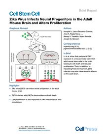 Zika: le virus menacerait aussi le cerveau des adultes