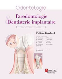 Parodontologie et dentisterie implantaire : Volume 1 : médecine parodontale (Coll. Traités)