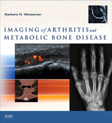 Imaging of Arthritis and Metabolic Bone Disease E-Book