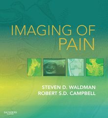 Imaging of Pain E-Book
