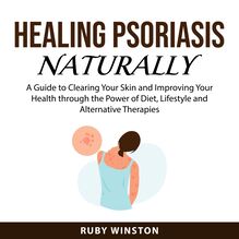 Healing Psoriasis Naturally