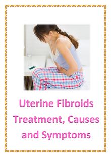 Uterine Fibroids Treatment, Causes and Symptoms