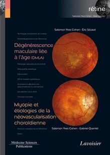  Dégénérescence maculaire liée à l âge (DMLA) / Myopie et étiologies de la néovascularisation choroïdienne (Coll. Coffret rétine, n°7)