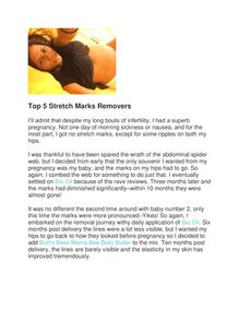 Top 5 Stretch Mark Removers