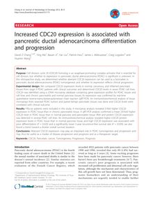 Increased CDC20 expression is associated with pancreatic ductal adenocarcinoma differentiation and progression