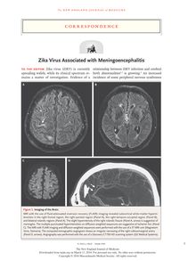 Zika lié à un cas de meningoencephalite