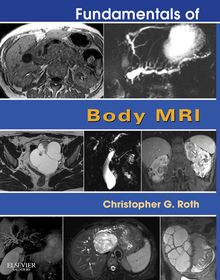 Fundamentals of Body MRI E-Book