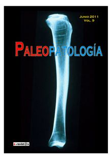 Revalorización del método paleoradiográfico para el estudio paleopatológico de restos óseos humanos antiguos