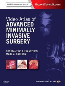 Video Atlas of Advanced Minimally Invasive Surgery E-Book