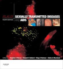 Atlas of Sexually Transmitted Diseases and AIDS E-Book