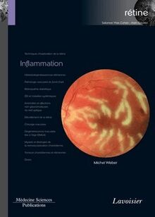 Inflammation (Coll. Coffret rétine, n°4)