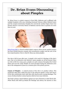 Dr. Brian Evans Discussing about Pimples