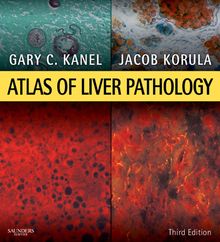 Atlas of Liver Pathology E-Book