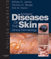 Andrew s Diseases of the Skin E-Book
