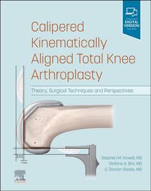 Calipered Kinematically aligned Total Knee Arthroplasty E-Book