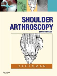 Shoulder Arthroscopy E-Book