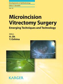 Microincision Vitrectomy Surgery