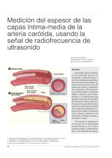Medición del espesor de las capas íntima-media de la arteria carótida, usando la señal de radiofrecuencia de ultrasonido