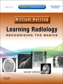 Learning Radiology: Recognizing the Basics E-Book