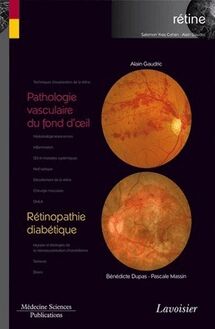 Pathologie vasculaire du fond d oeil / Rétinopathie diabétique (Coll. Coffret rétine, n°3)