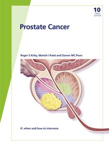 Fast Facts: Prostate Cancer