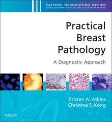 Practical Breast Pathology: A Diagnostic Approach E-Book