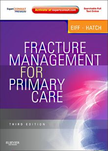 Fracture Management for Primary Care E-Book