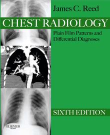 Chest Radiology Plain Film Patterns and Differential Diagnoses E-Book