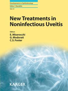 New Treatments in Noninfectious Uveitis