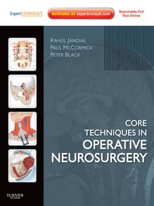 Core Techniques in Operative Neurosurgery E-Book