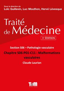 Malformations vasculaires