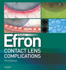 Contact Lens Complications E-Book