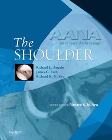 AANA Advanced Arthroscopy: The Shoulder E-Book