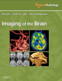 Imaging of the Brain E-Book