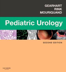 Pediatric Urology E-Book