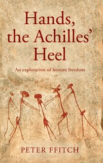 Hands, the Achilles  Heel