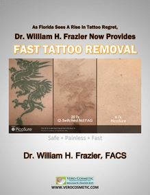 As Florida Sees A Rise In Tattoo Regret Dr William H Frazier Now Provides Fast Tattoo Removal