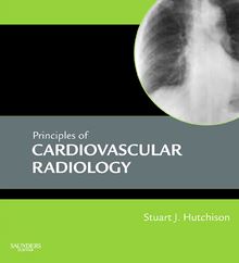 Principles of Cardiovascular Radiology E-Book