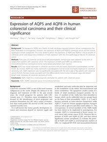 Expression of AQP5 and AQP8 in human colorectal carcinoma and their clinical significance