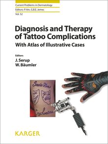 Diagnosis and Therapy of Tattoo Complications