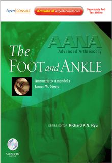 AANA Advanced Arthroscopy: The Foot and Ankle E-Book