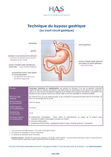 Obésité  prise en charge chirurgicale chez l adulte - Brochure patients - BPG - Court-circuit gastrique (bypass gastrique) - Fiche technique