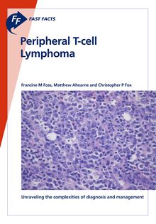 Fast Facts: Peripheral T-cell Lymphoma