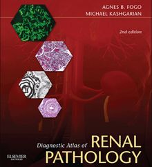 Diagnostic Atlas of Renal Pathology E-Book