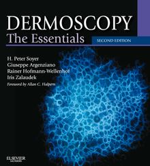 Dermoscopy E-Book