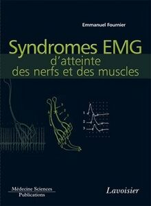 Syndromes EMG d atteinte des nerfs et des muscles